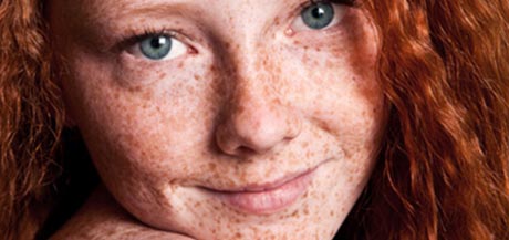 Soleil et peau : les risques de vieillissement, taches et cancer de la peau